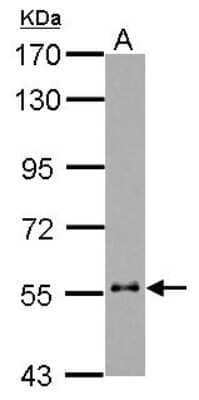 Western Blot: Cytokeratin 6b Antibody [NBP2-14924]