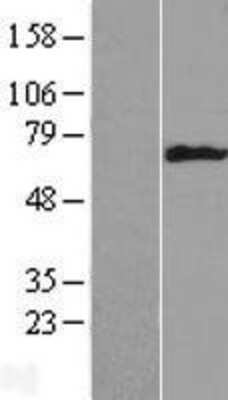 Western Blot: Cytokeratin 6b Overexpression Lysate [NBL1-12395]