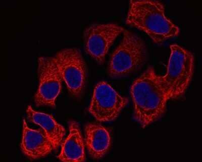 Immunocytochemistry/ Immunofluorescence: Cytokeratin 7/13/17/18 Antibody (ST50-05) [NBP2-67533]