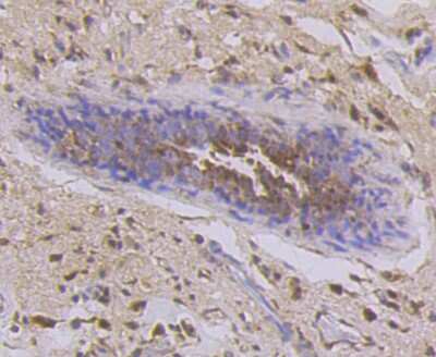 Immunohistochemistry-Paraffin: Cytokeratin 7/13/17/18 Antibody (ST50-05) [NBP2-67533]