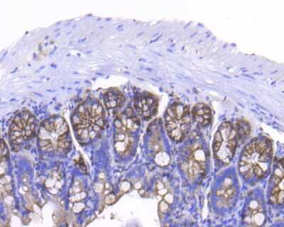 Immunohistochemistry-Paraffin: Cytokeratin 7/13/17/18 Antibody (ST50-05) [NBP2-67533]