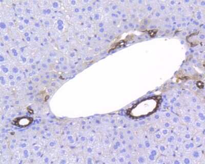 Immunohistochemistry-Paraffin: Cytokeratin 7/13/17/18 Antibody (ST50-05) [NBP2-67533]