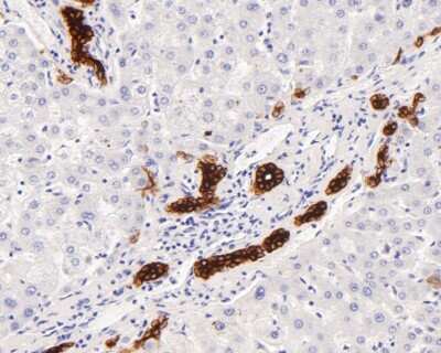 Immunohistochemistry-Paraffin: Cytokeratin 7/13/17/18 Antibody (ST50-05) [NBP2-67533]