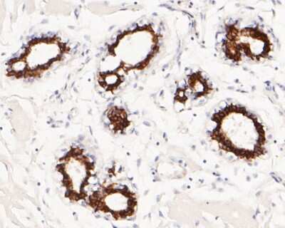 Immunohistochemistry-Paraffin: Cytokeratin 7/13/17/18 Antibody (ST50-05) [NBP2-67533]