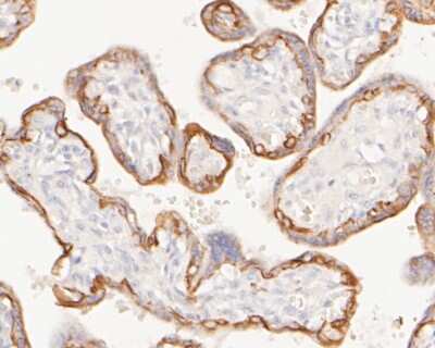 Immunohistochemistry-Paraffin: Cytokeratin 7/13/17/18 Antibody (ST50-05) [NBP2-67533]