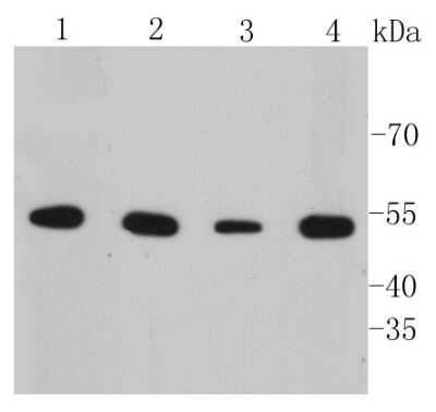 Western Blot: Cytokeratin 7/13/17/18 Antibody (ST50-05) [NBP2-67533]