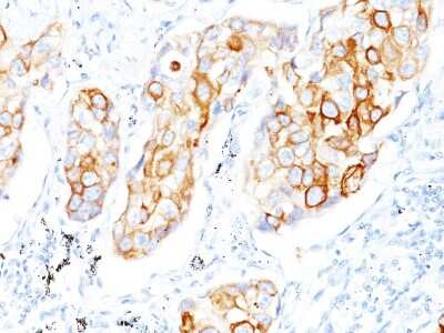 Immunohistochemistry-Paraffin: Cytokeratin 7/17 Antibody (C-46) - Azide and BSA Free [NBP3-08343]