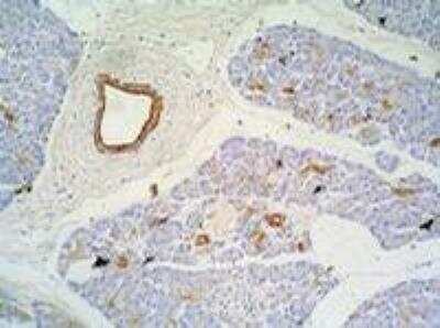 Immunohistochemistry: Cytokeratin 7/17 Antibody (C-46) - BSA Free [NB500-352]