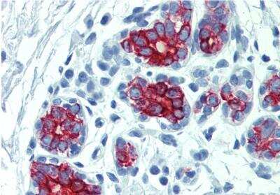 Immunohistochemistry-Paraffin: Cytokeratin 7/17 Antibody (C-46) - BSA Free [NB500-352]