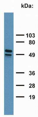 Western Blot: Cytokeratin 7/17 Antibody (C-46)BSA Free [NB500-352]