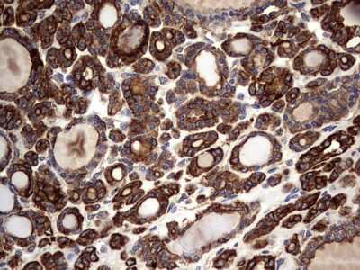 Immunohistochemistry: Cytokeratin 7 Antibody (OTI2A2) [NBP2-45578]