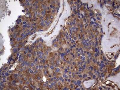 Immunohistochemistry: Cytokeratin 7 Antibody (OTI2A2) [NBP2-45578]