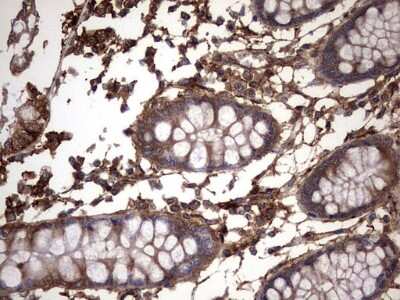 Immunohistochemistry: Cytokeratin 7 Antibody (OTI2A2) [NBP2-45578]
