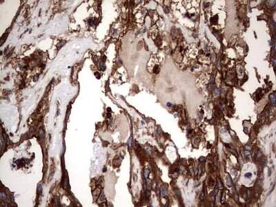 Immunohistochemistry: Cytokeratin 7 Antibody (OTI2A2) [NBP2-45578]