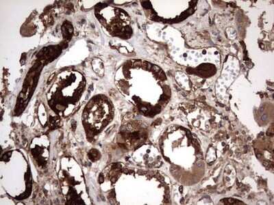 Immunohistochemistry: Cytokeratin 7 Antibody (OTI2A2) [NBP2-45578]