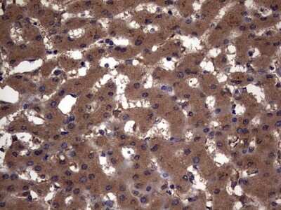 Immunohistochemistry: Cytokeratin 7 Antibody (OTI2A2) [NBP2-45578]