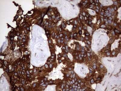 Immunohistochemistry: Cytokeratin 7 Antibody (OTI2A2) [NBP2-45578]