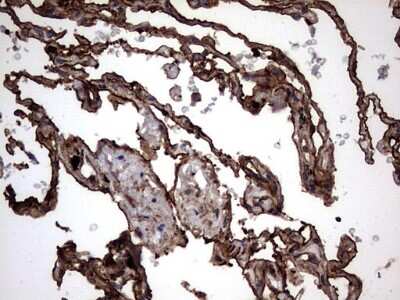 Immunohistochemistry: Cytokeratin 7 Antibody (OTI2A2) [NBP2-45578]