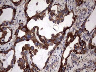 Immunohistochemistry: Cytokeratin 7 Antibody (OTI2A2) [NBP2-45578]
