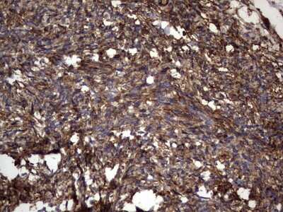 Immunohistochemistry: Cytokeratin 7 Antibody (OTI2A2) [NBP2-45578]