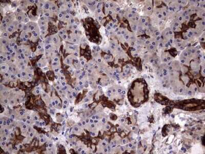 Immunohistochemistry: Cytokeratin 7 Antibody (OTI2A2) [NBP2-45578]