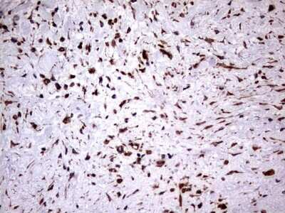Immunohistochemistry: Cytokeratin 7 Antibody (OTI2A2) [NBP2-45578]