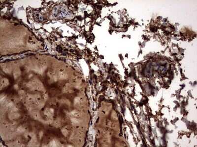 Immunohistochemistry: Cytokeratin 7 Antibody (OTI2A2) [NBP2-45578]