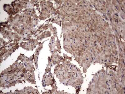Immunohistochemistry: Cytokeratin 7 Antibody (OTI2A2) [NBP2-45578]