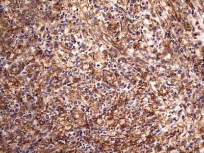 Immunohistochemistry: Cytokeratin 7 Antibody (OTI2A2) [NBP2-45578]