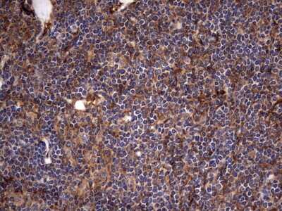 Immunohistochemistry: Cytokeratin 7 Antibody (OTI2A2) [NBP2-45578]