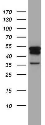 Western Blot: Cytokeratin 7 Antibody (OTI2A2) [NBP2-45578]