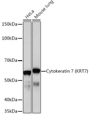 Western Blot: Cytokeratin 7 Antibody (5V4M10) [NBP3-16388]