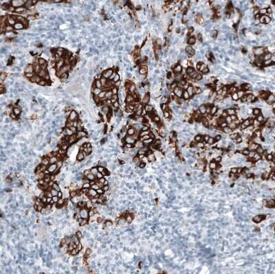 Immunohistochemistry-Paraffin: Cytokeratin 7 Antibody (CL8723) [NBP2-88918]