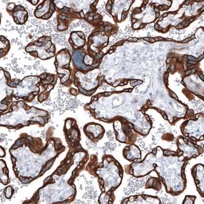 Immunohistochemistry-Paraffin: Cytokeratin 7 Antibody (CL8723) [NBP2-88918]