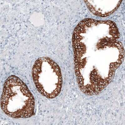 Immunohistochemistry-Paraffin: Cytokeratin 7 Antibody (CL8723) [NBP2-88918]