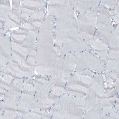 Immunohistochemistry-Paraffin: Cytokeratin 7 Antibody (CL8723) [NBP2-88918]