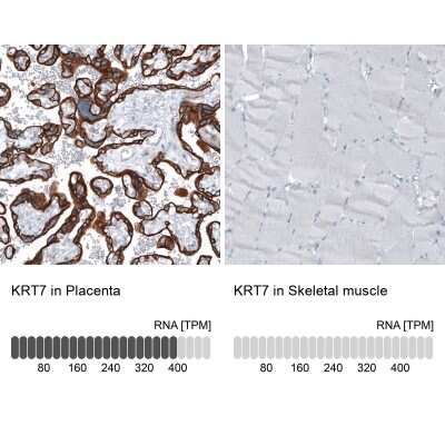 Immunohistochemistry-Paraffin: Cytokeratin 7 Antibody (CL8723) [NBP2-88918]