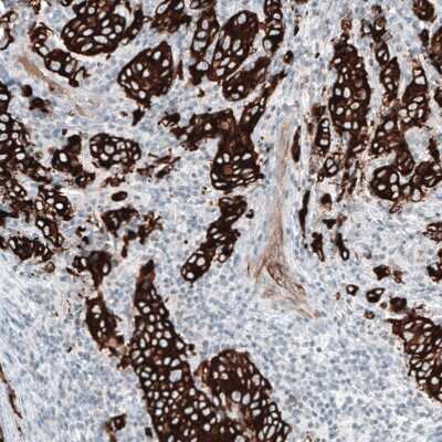 Immunohistochemistry-Paraffin: Cytokeratin 7 Antibody (CL8725) [NBP2-88919]