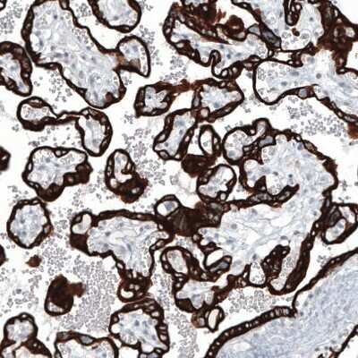 Immunohistochemistry-Paraffin: Cytokeratin 7 Antibody (CL8725) [NBP2-88919]