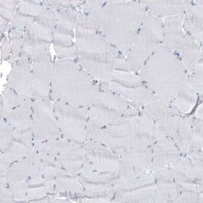 Immunohistochemistry-Paraffin: Cytokeratin 7 Antibody (CL8725) [NBP2-88919]