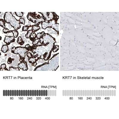 Immunohistochemistry-Paraffin: Cytokeratin 7 Antibody (CL8725) [NBP2-88919]