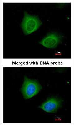 Immunocytochemistry/ Immunofluorescence: Cytokeratin 7 Antibody [NBP1-33104]