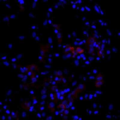 Immunohistochemistry-Frozen: Cytokeratin 7 Antibody [NBP1-33104]