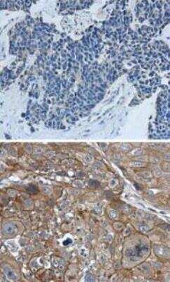 Immunohistochemistry: Cytokeratin 7 Antibody [NBP1-33104]