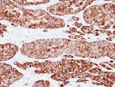 Immunohistochemistry-Paraffin: Cytokeratin 7 Antibody [NBP1-33104]