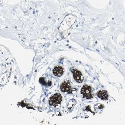 Immunohistochemistry-Paraffin: Cytokeratin 7 Antibody [NBP1-88080]