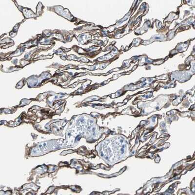 Immunohistochemistry-Paraffin: Cytokeratin 7 Antibody [NBP1-88080]