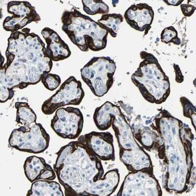 Immunohistochemistry-Paraffin: Cytokeratin 7 Antibody [NBP1-88080]