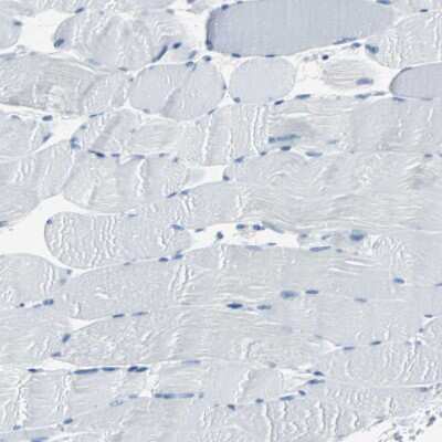 Immunohistochemistry-Paraffin: Cytokeratin 7 Antibody [NBP1-88080]