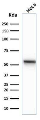 Western Blot: Cytokeratin 7 Antibody (K72.7)Azide and BSA Free [NBP2-47941]